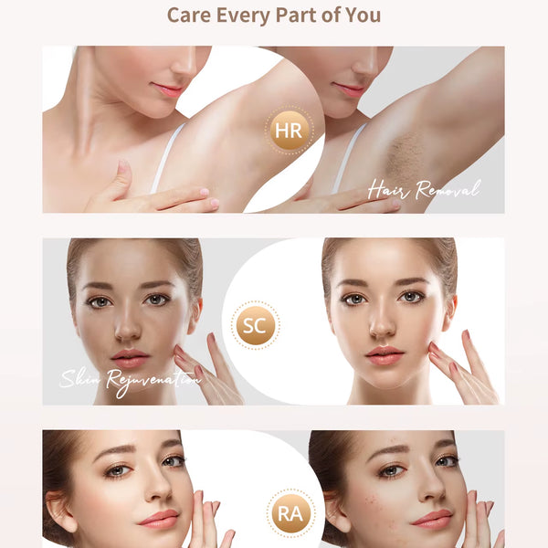 Laser Hair Removal IPL 3-In-1 Effective Hair Removal Device 9 Levels 999,900 Light Pulses Women Men Full Body Treatment Home Use