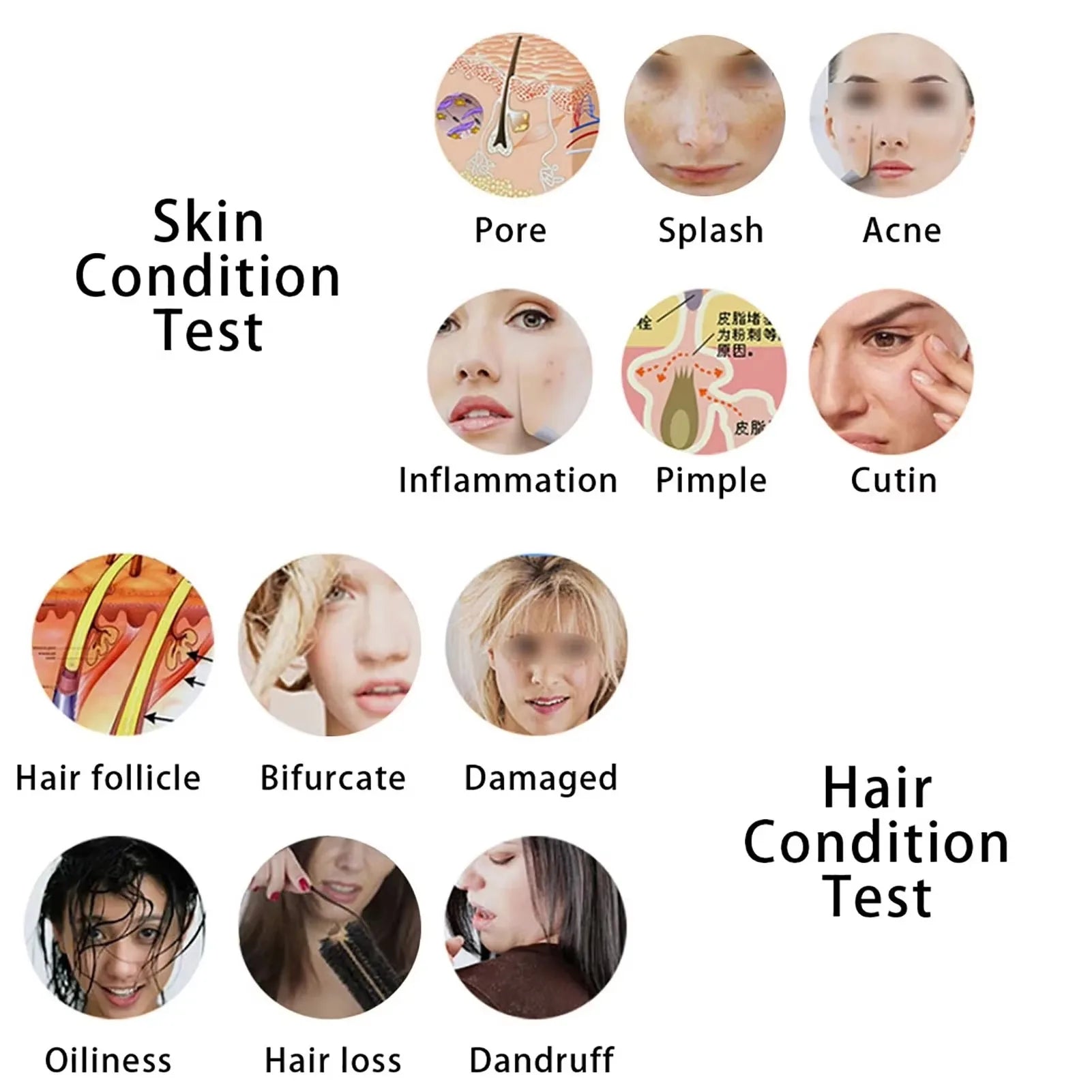 5 Inch Skin Analyzer Skin Hair Scalp Detector Dermoscopy Tester Analyser for Diagnosis Skin Care Tools with 2 Lens Rechargeable