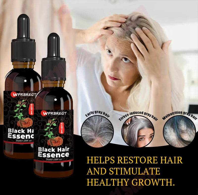 Hair care essential oil nourishes the scalp to produce black hair and refreshing oil control to strengthen hair roots