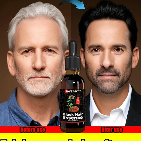 Hair care essential oil nourishes the scalp to produce black hair and refreshing oil control to strengthen hair roots