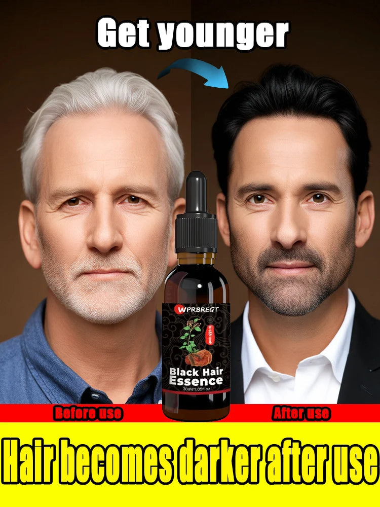 Hair care essential oil nourishes the scalp to produce black hair and refreshing oil control to strengthen hair roots