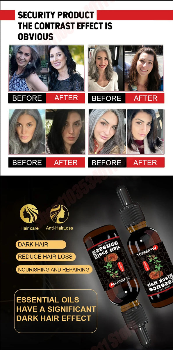 Hair care essential oil nourishes the scalp to produce black hair and refreshing oil control to strengthen hair roots