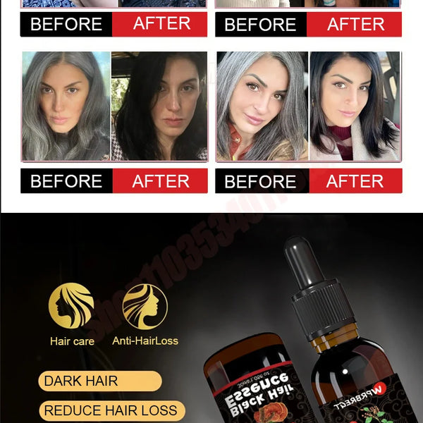 Hair care essential oil nourishes the scalp to produce black hair and refreshing oil control to strengthen hair roots