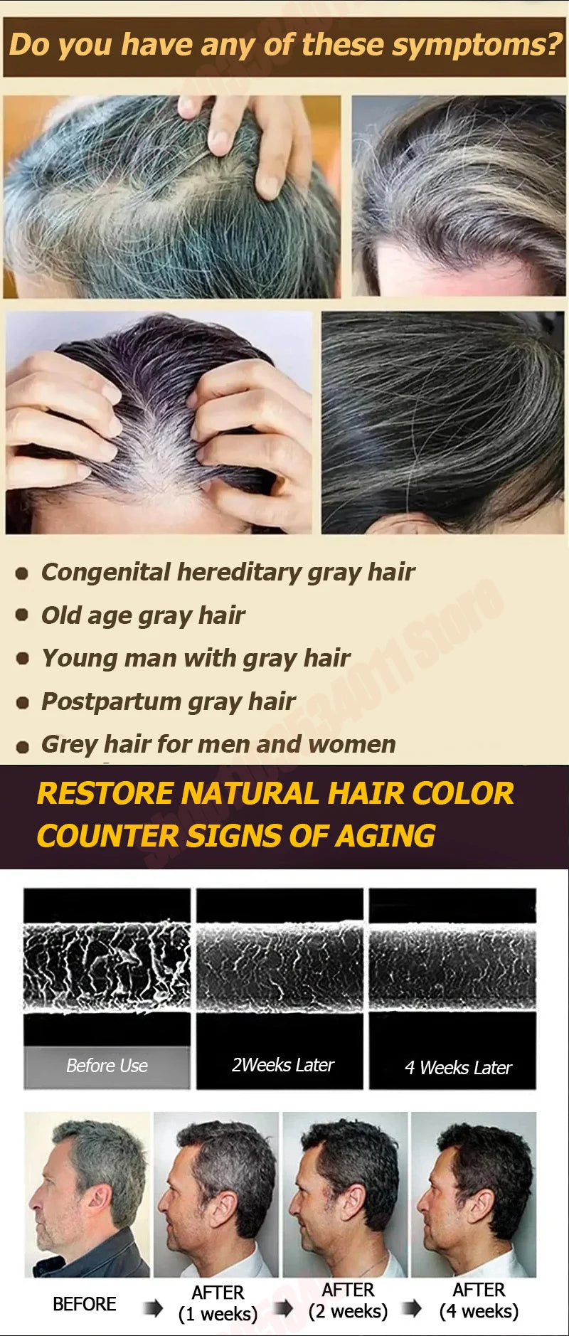 Hair care essential oil nourishes the scalp to produce black hair and refreshing oil control to strengthen hair roots