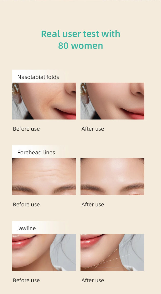 KiCA Skincare Device Face Lifting Tighten Skin Rejuvenation Gentle Warm Compress Ion Therapy Enhanced Cleansing Tool